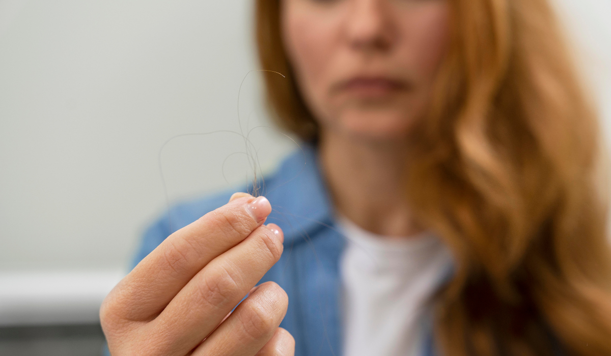 Caída de pelo en otoño, ¿cómo prevenirla?